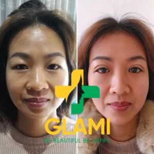 Beauty Lào Cai Signature 08